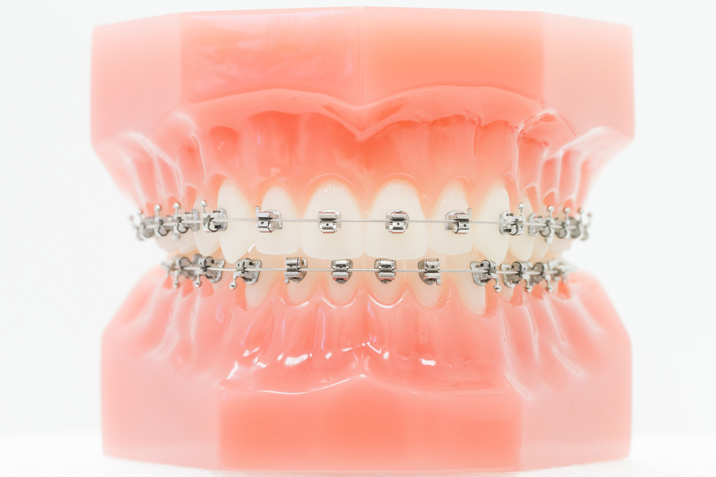 Ihre Praxis für Kieferorthopädie in Penzberg mit einem modernen Behandlungskonzept. Wir sind Ihre Experten für Kieferorthopädie bei Kindern, Jugendlichen & Erwachsenen.