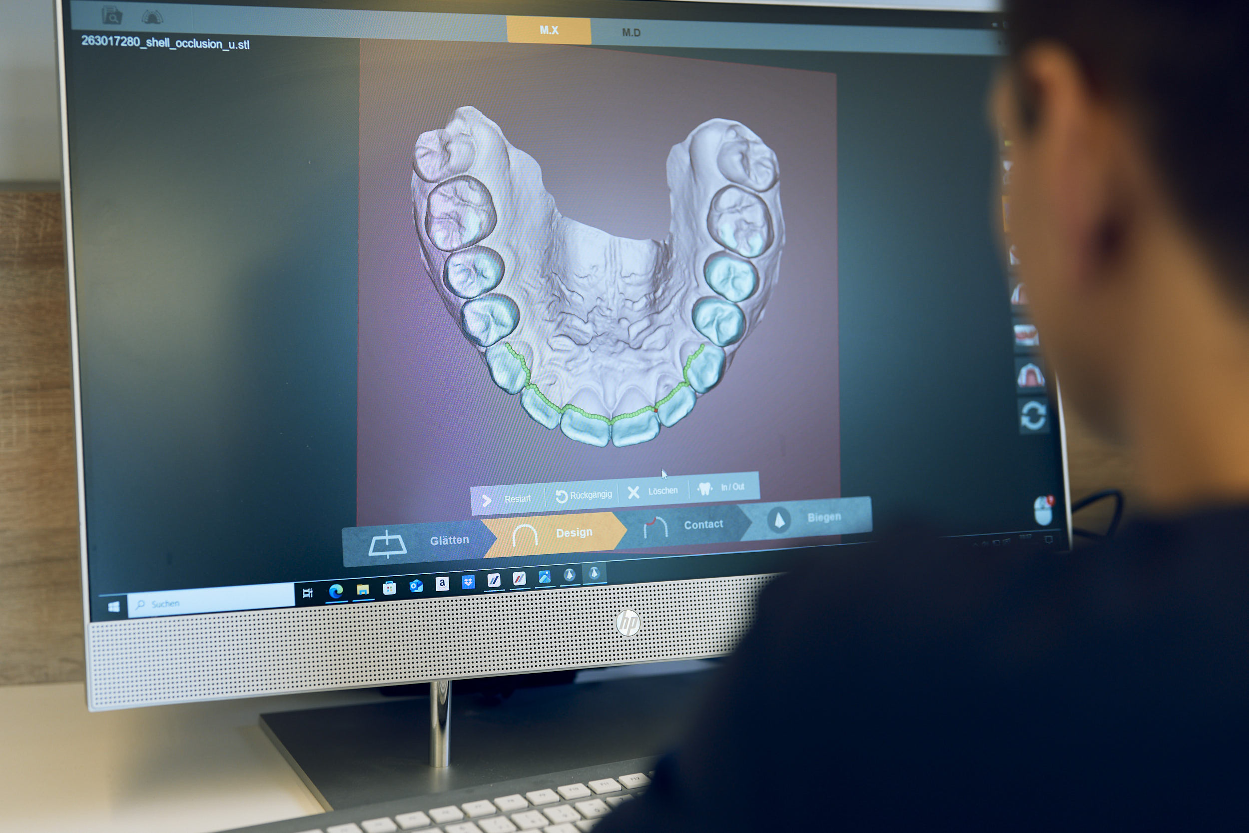 Ihre Praxis für Kieferorthopädie in Penzberg mit einem modernen Behandlungskonzept. Wir sind Ihre Experten für Kieferorthopädie bei Kindern, Jugendlichen & Erwachsenen.
